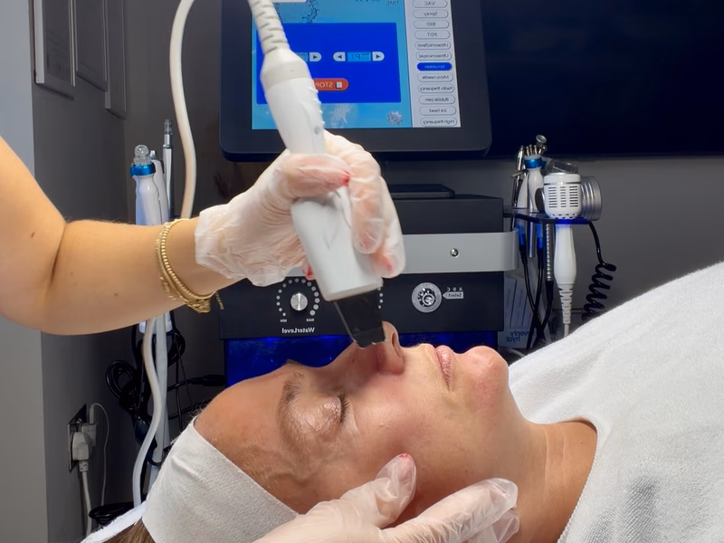 A facial handpiece being used during a deep exfoliation treatment